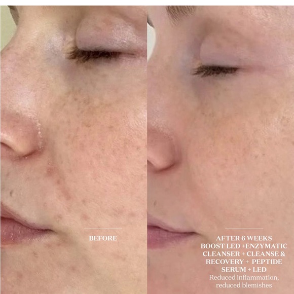 NIB the light salon boost Enzymatic Cleanser & Mask $48 insane deal - Picture 8 of 10